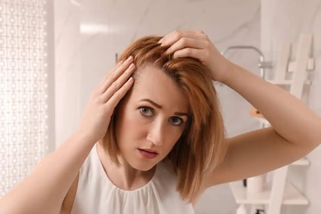 alopecia-femenina-frontal-consejos