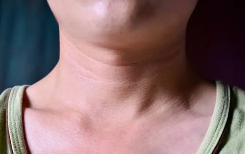 como-quitar-las-arrugas-del-cuello-01