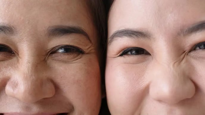 lineas-de-expresion-ojos-edad