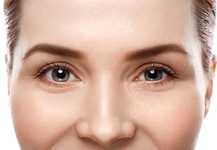 lineas-de-expresion-ojos-eliminar