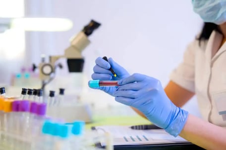 proteina-c-reactiva–alta-causas-analisis