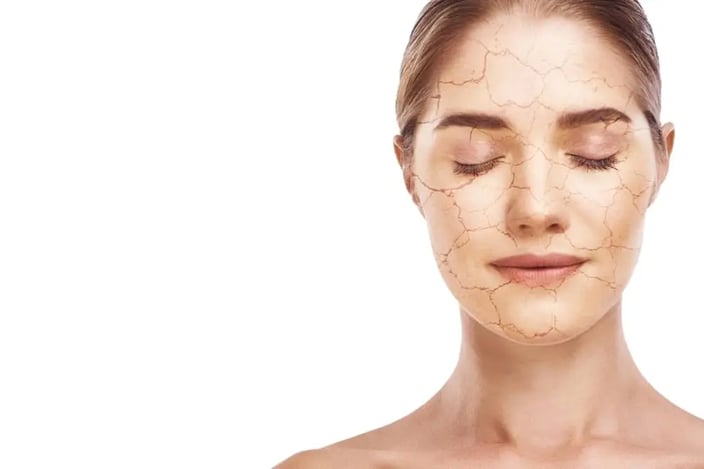 remedios-caseros-para-piel-seca-y-escamosa-rostro-danado