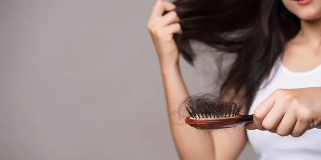 Alopecia femenina frontal: causas y remedios naturales