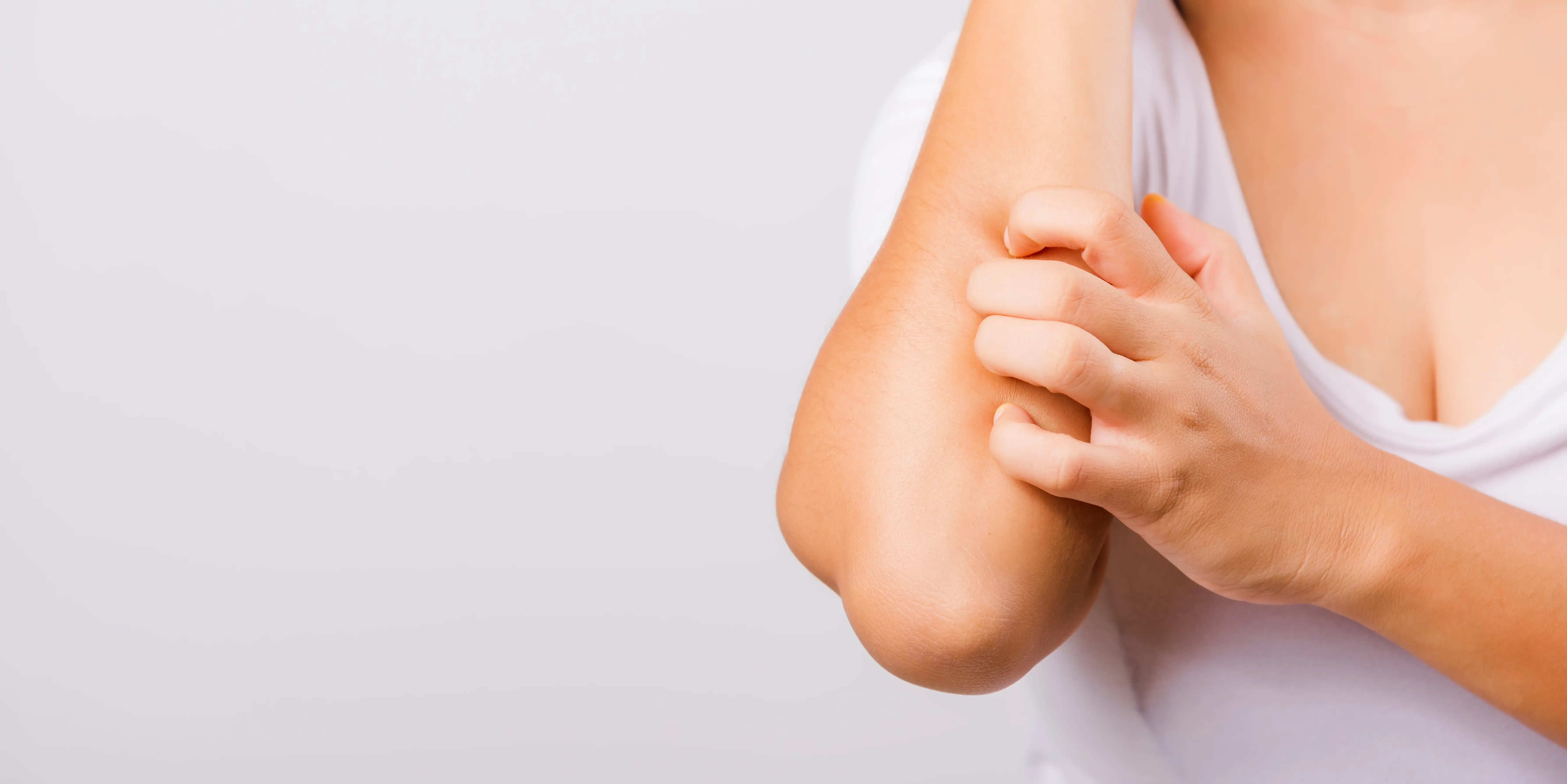 Dermatitis por estrés: cómo combatir esta alteración de la piel