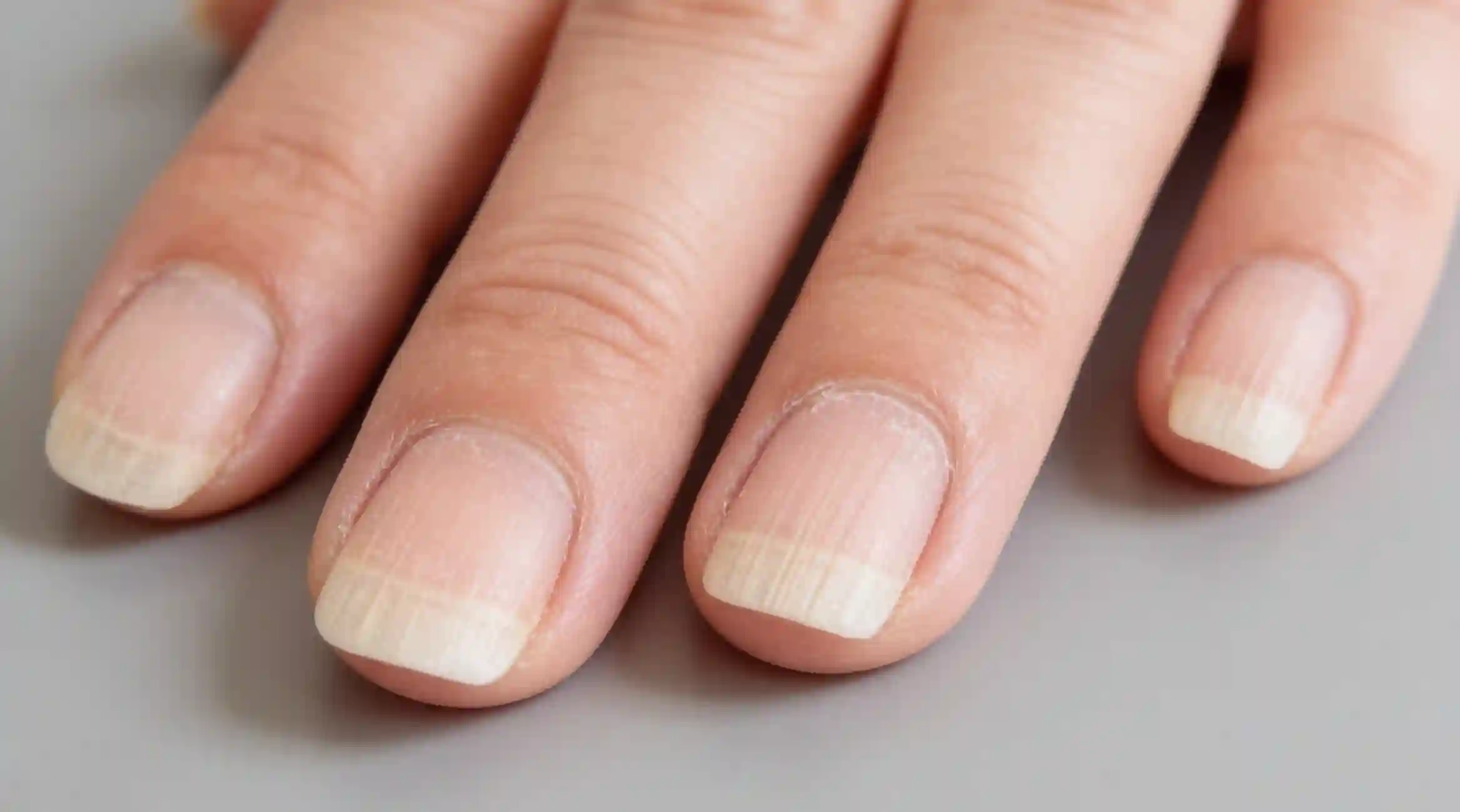 ¿Uñas estriadas? Te contamos porqué ocurre y cómo prevenirlas